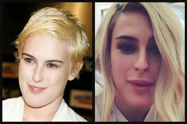 Rumer Willis Lip Augmentation Plastic Surgery Before and After