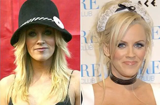 Jenny McCarthy Plastic Surgery Before and After Botox Injections