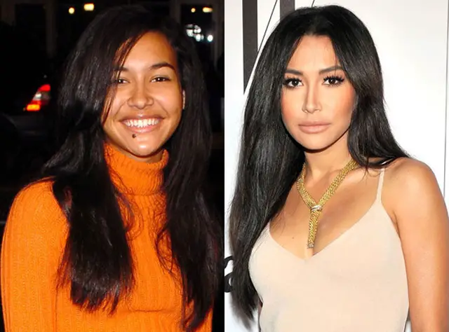 Naya Rivera Nose Job Plastic Surgery Before and After