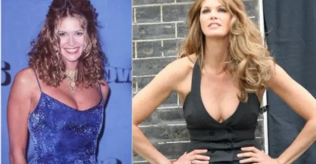 Elle Macpherson Breast Implants Plastic Surgery Before and After
