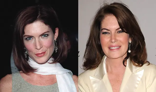 Lara Flynn Boyle Plastic Surgery Before and After Botox Injections