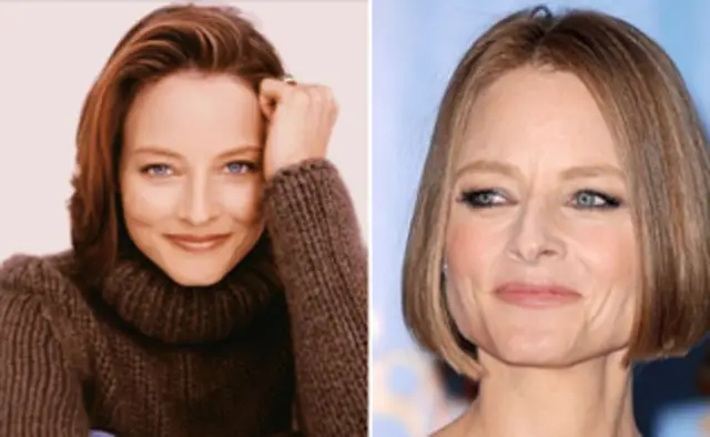 Jodie Foster Facelift Plastic Surgery Before and After
