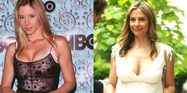 Mira Sorvino Breast Implants Plastic Surgery Before and After