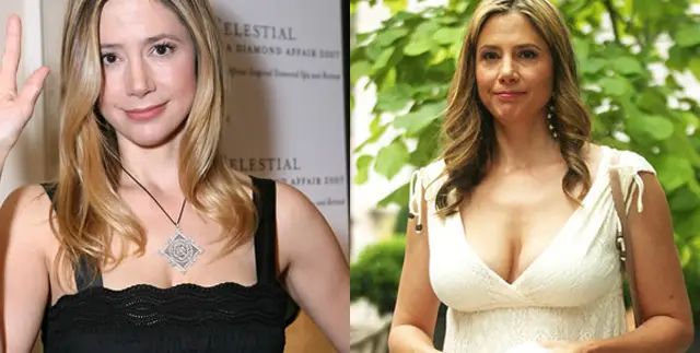 Mira Sorvino Breast Implants Plastic Surgery Before and After