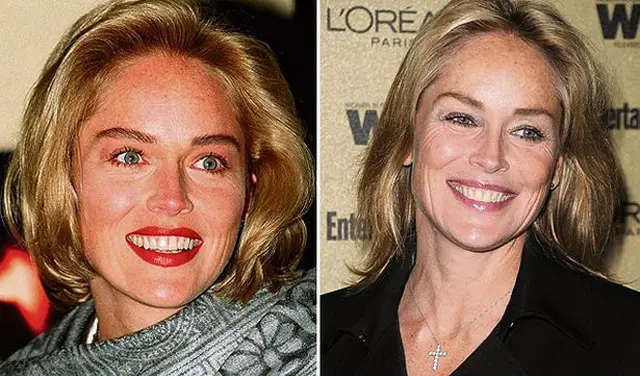 Sharon Stone Facelift Plastic Surgery Before and After