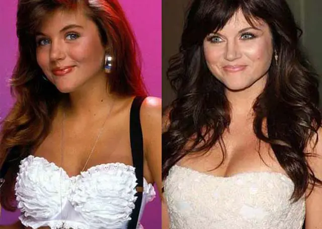 Tiffani Thiessen Breast Implants Plastic Surgery Before and After