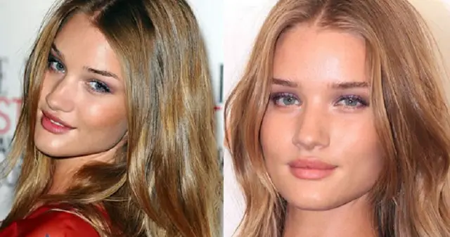 Rosie Huntington-Whiteley Nose Job Plastic Surgery Before and After