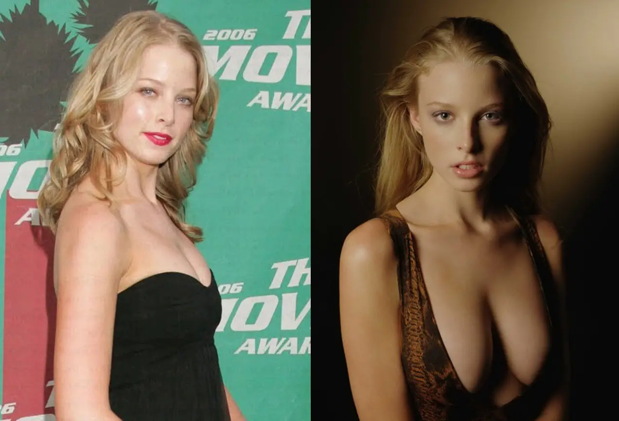 Rachel Nichols Breast Augmentation Plastic Surgery Before and After