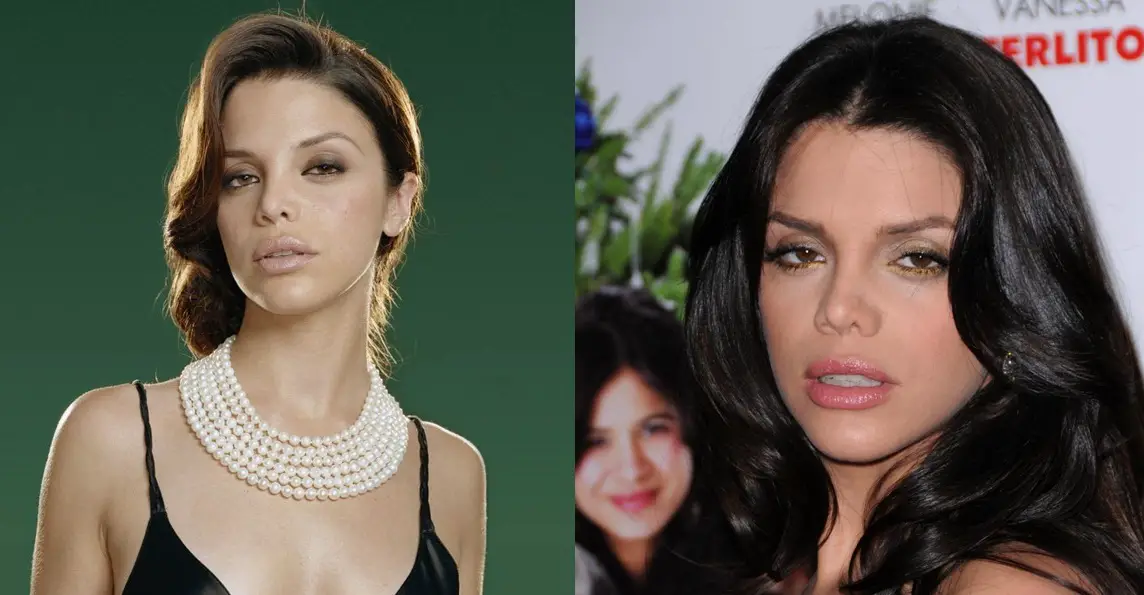 Vanessa Ferlito Nose Job Plastic Surgery Before and After
