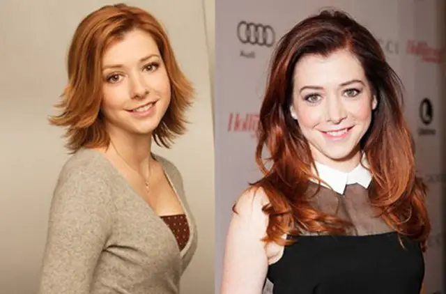 Alyson Hannigan Facelift