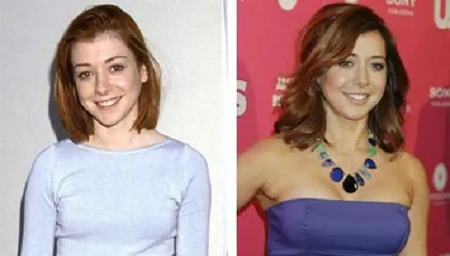 Alyson Hannigan Breast Implants