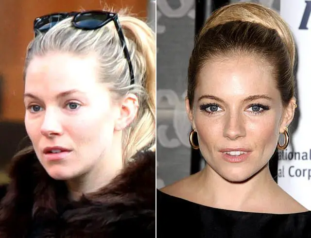 Sienna Miller Plastic Surgery Before and After