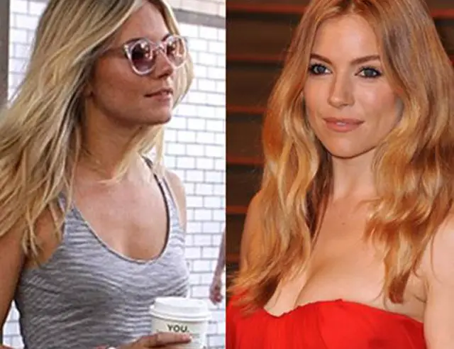 Sienna Miller Plastic Surgery Before and After