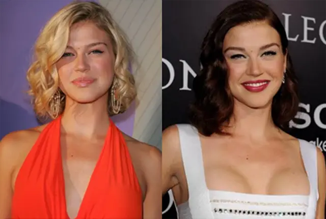 Adrianne Palicki Plastic Surgery Before and After