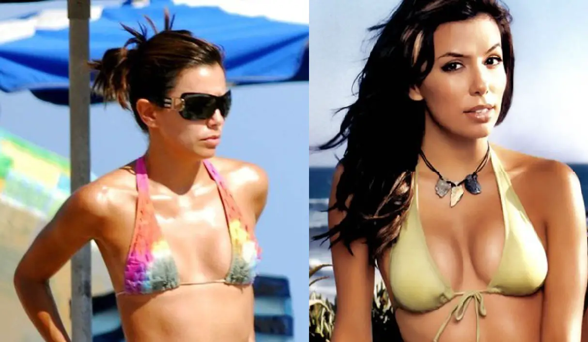Eva Longoria Breast Augmentation Plastic Surgery Before and After