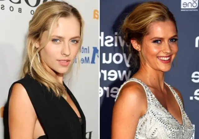 Teresa Palmer Plastic Surgery Before and After
