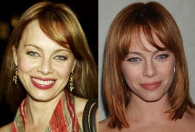 Melinda Clarke Plastic Surgery Before and After