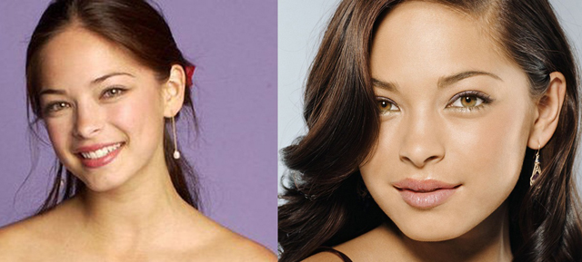 Kristin Kreuk Plastic Surgery Before and After