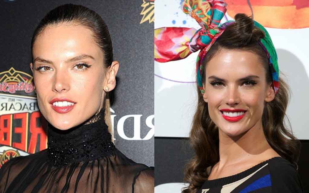 Alessandra Ambrosio Plastic Surgery Before And After