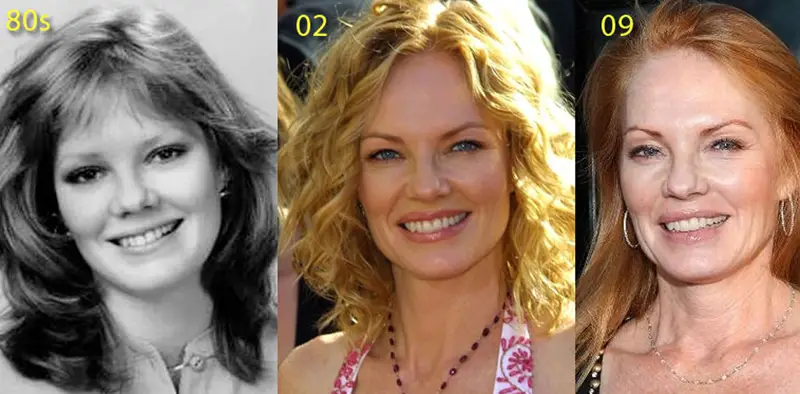 Marg Helgenberger Plastic Surgery Before and After