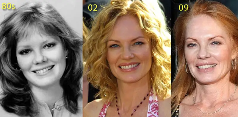 Marg Helgenberger Plastic Surgery Before and After.