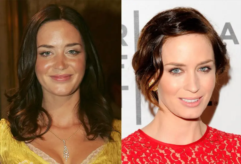 Emily Blunt Plastic Surgery Before and After