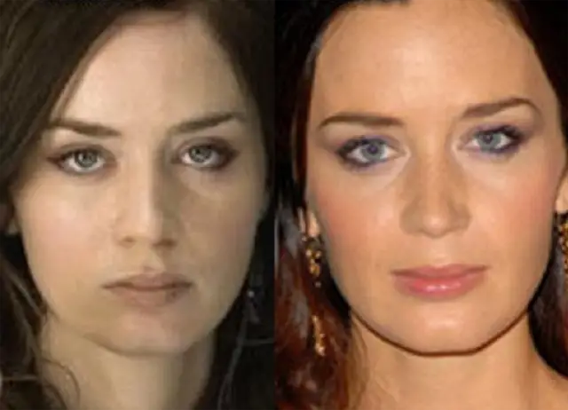 Emily Blunt Nose Job