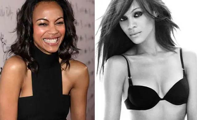 Zoe Saldana Plastic Surgery Before and After