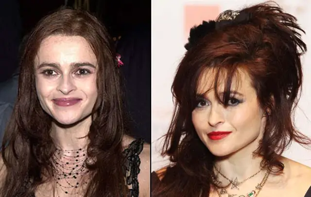 Helena Bonham Carter Plastic Surgery Before and After