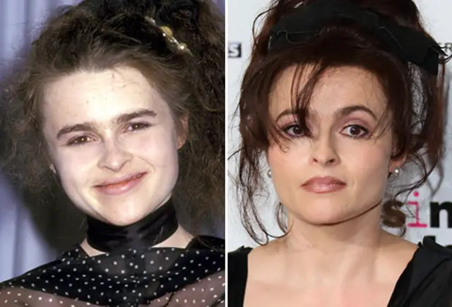 Helena Bonham Carter Plastic Surgery Before and After