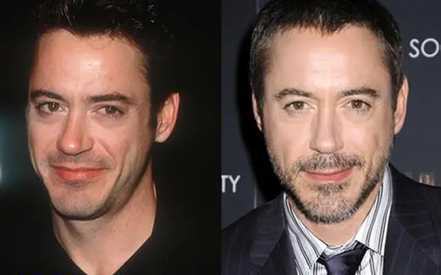 robert downej jr plastic surgery