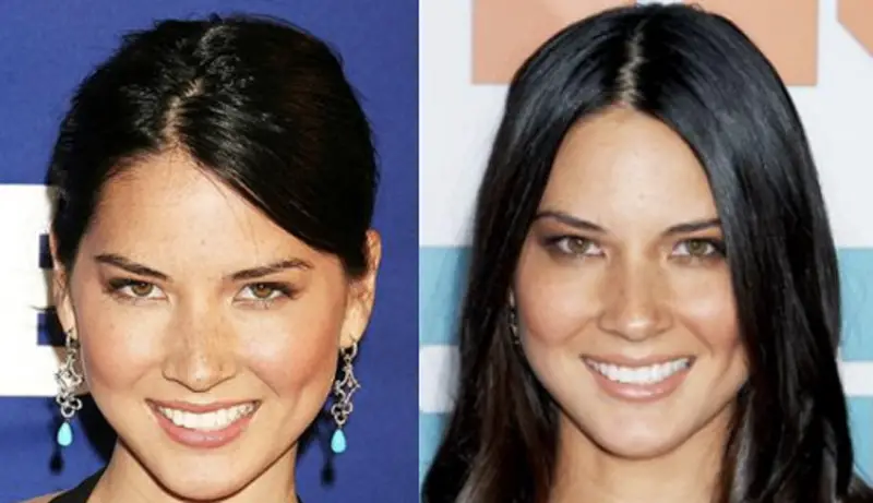 Olivia Munn Plastic Surgery Before And After Celebie