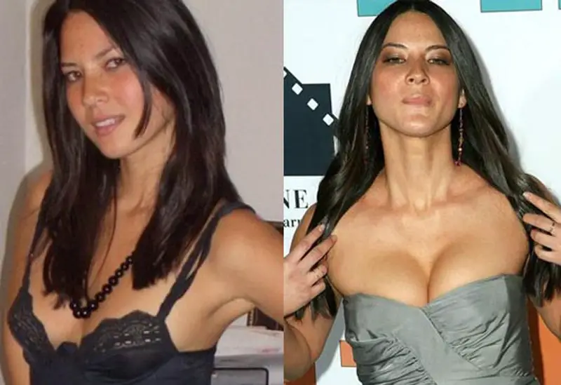Olivia Munn Plastic Surgery Before And After.