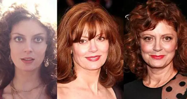 Susan Sarandon Plastic Surgery