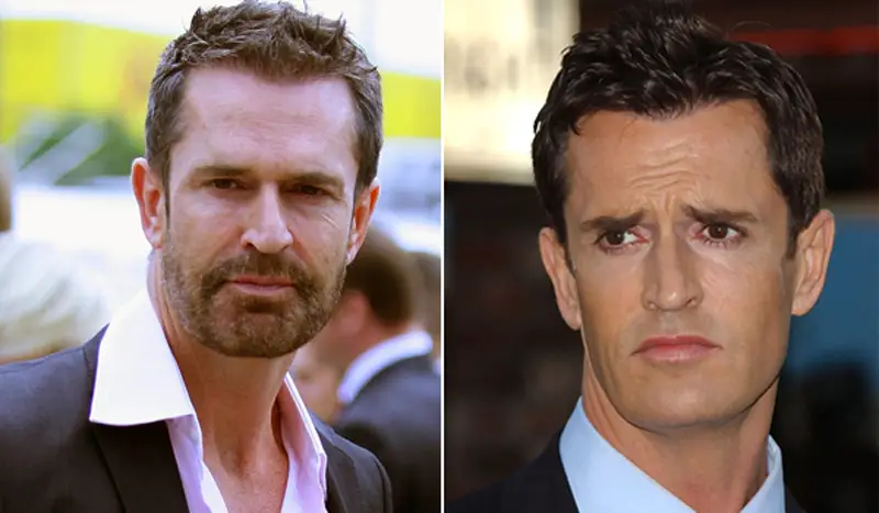 Rupert Everett Plastic Surgery Before and After