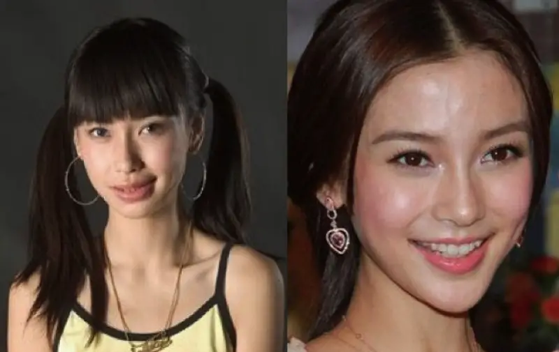 Angelababy Plastic Surgery Before and After.
