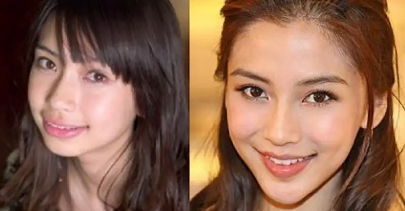 Angelababy Plastic Surgery Before and After