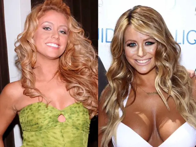 Aubrey O'Day Breast Implants