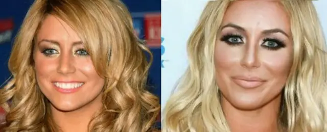 Aubrey O'Day Plastic Surgery Before and After