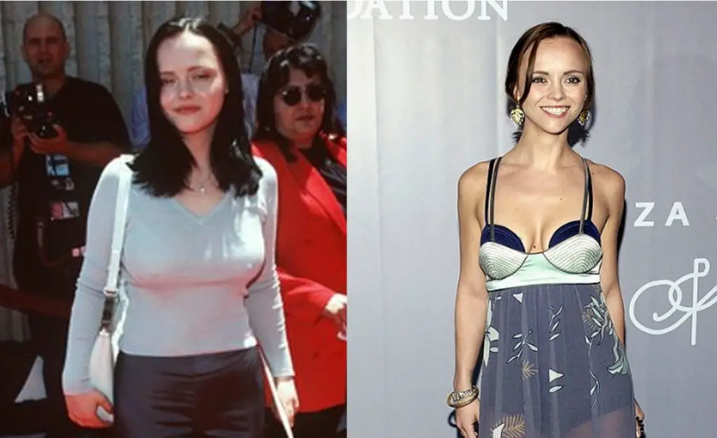 Christina Ricci Plastic Surgery