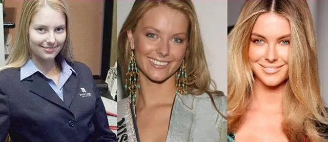 Jennifer Hawkins Plastic Surgery Before and After