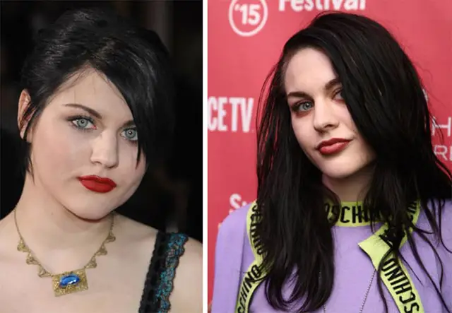 Frances Bean Cobain Plastic Surgery Before and After