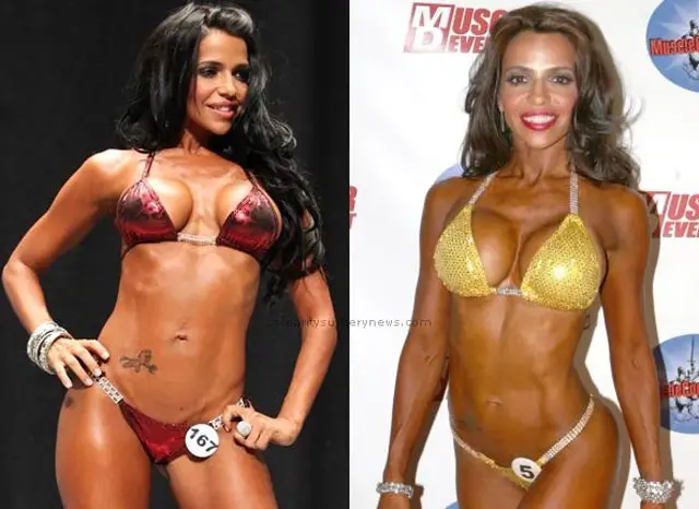 Vida Guerra Plastic Surgery Before and After