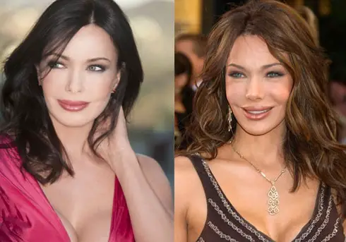 Hunter Tylo Plastic Surgery Before and After