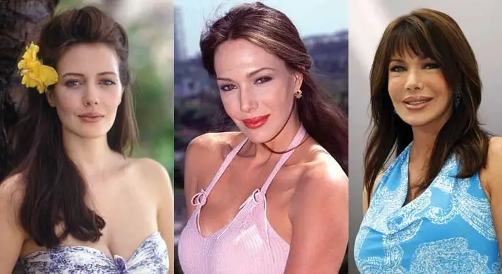 Hunter Tylo Plastic Surgery Before and After