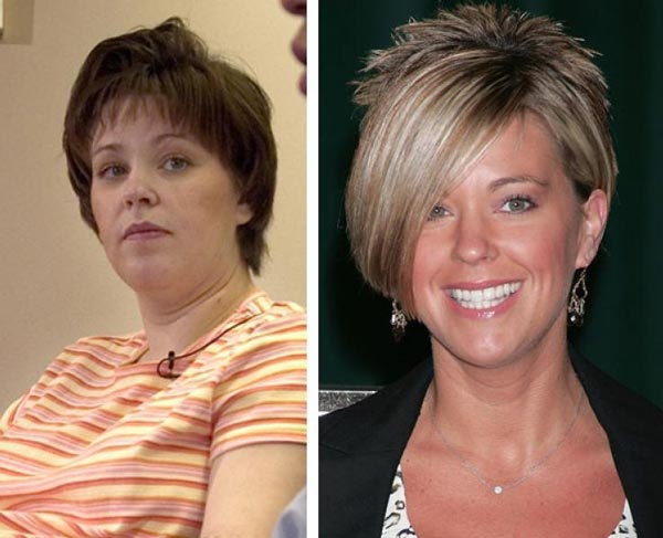 Kate Gosselin Plastic Surgery Before And After Celebie 7769