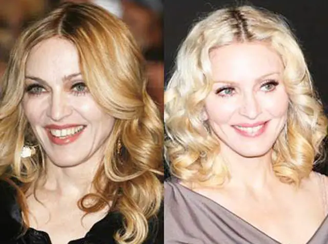 Madonna Plastic Surgery Before and After | Celebie