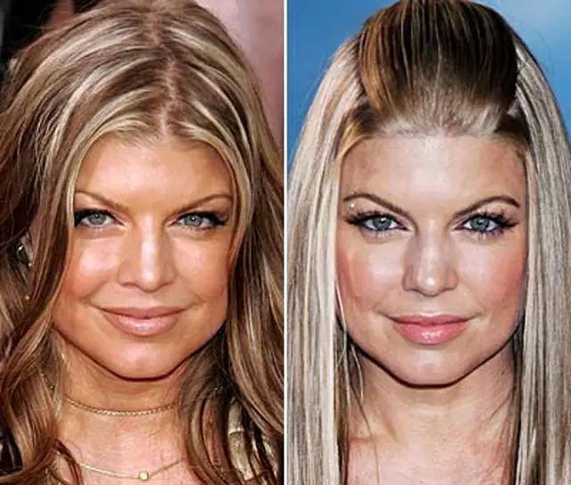 Fergie Nose Job Plastic Surgery Before and After Celebie