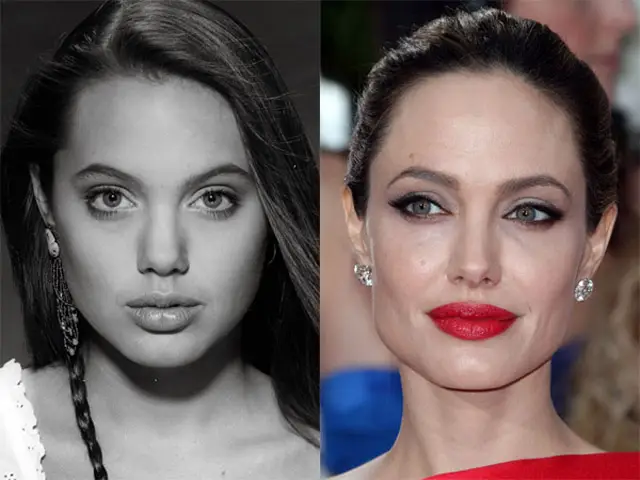 Angelina Jolie Nose Job Plastic Surgery Before and After Celebie