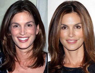 Cindy Crawford Nose Job Plastic Surgery Before and After | Celebie